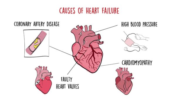 World Heart Federation Roadmap on Heart Failure - World Heart Federation