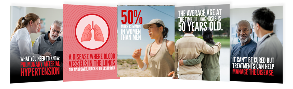 Pulmonary arterial hypertension posters