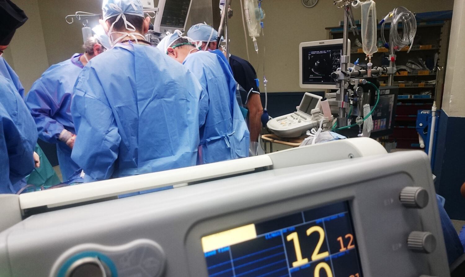 Team of surgeons in blue scrubs performing an operation in an operating room, surrounded by medical equipment and a monitor displaying vital signs in the foreground