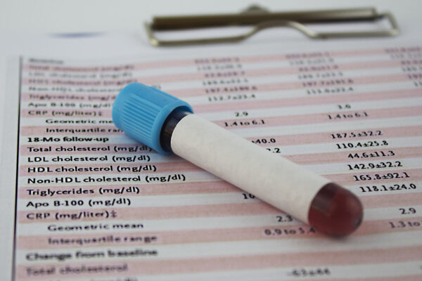 cholesterol and blood test results in laboratory.
