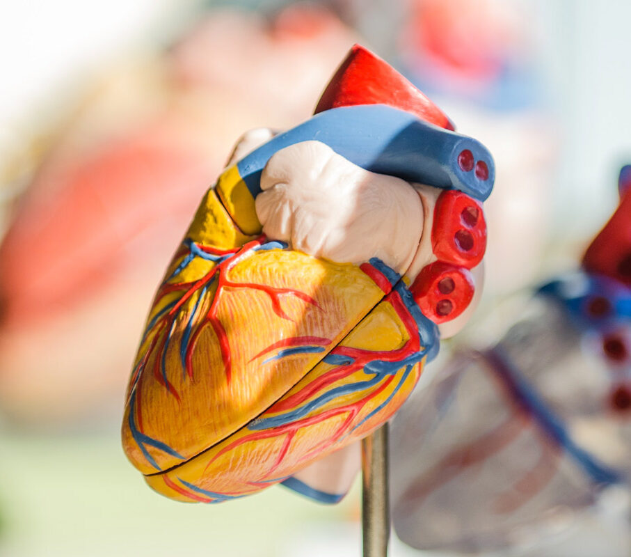 model of a heart showing different blood vessel